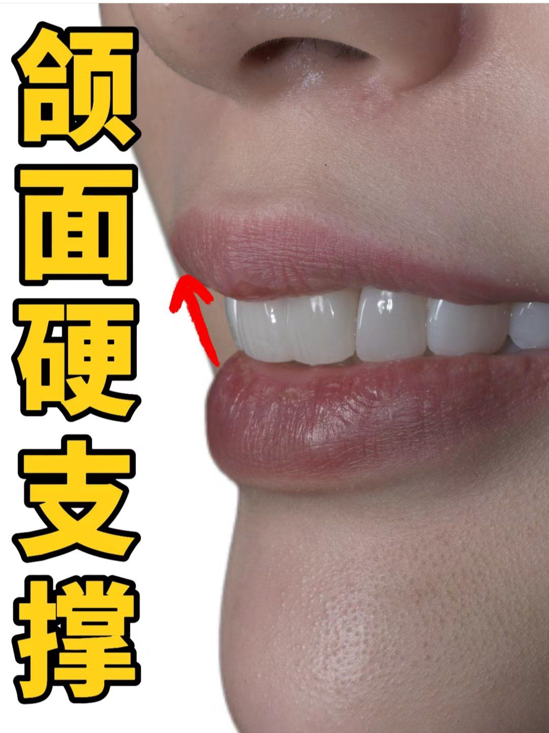 
	
[狗头]牙齿内扣
牙齿内扣是由于牙面角度