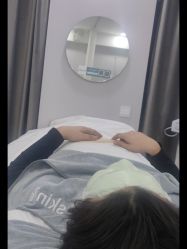 体验前-SKIN79皮肤管理中心