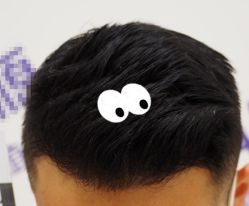 -大麦微针植发全国连锁