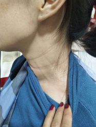 -北京美痣堂古方祛痣斑疣瘊