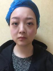 体验前-成都军建医院·医疗整形