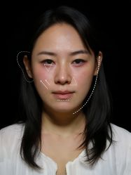 -上海伊莱美医疗美容医院