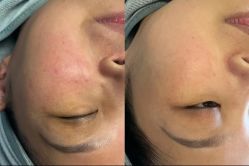 点击看大图 -SKIN79皮肤管理中心