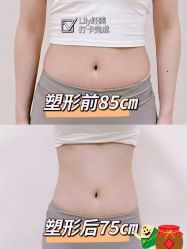 -Lily纤美·科技减脂中心