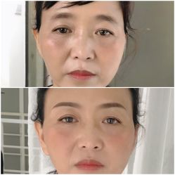 -Doris多里斯半永久纹眉·SMP纹发·发际线
