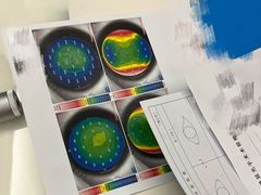 -杭州明视康眼科医院