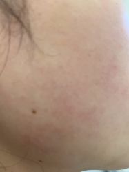 -蕾特恩专业祛痘·皮肤管理