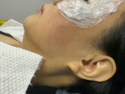 -长沙雅美医疗美容医院