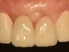 -精德口腔·种植修复·儿牙中心(财富中心店)