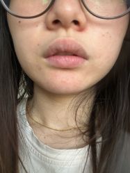 体验前-佛山艺美医疗美容·整形·美肤·塑形