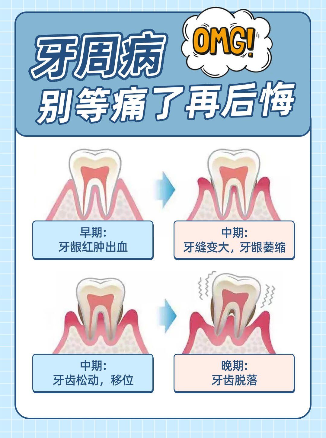 牙龈为什么会出血 牙龈为什么会出血