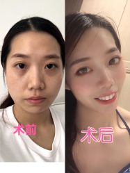 -广东韩妃整形外科医院