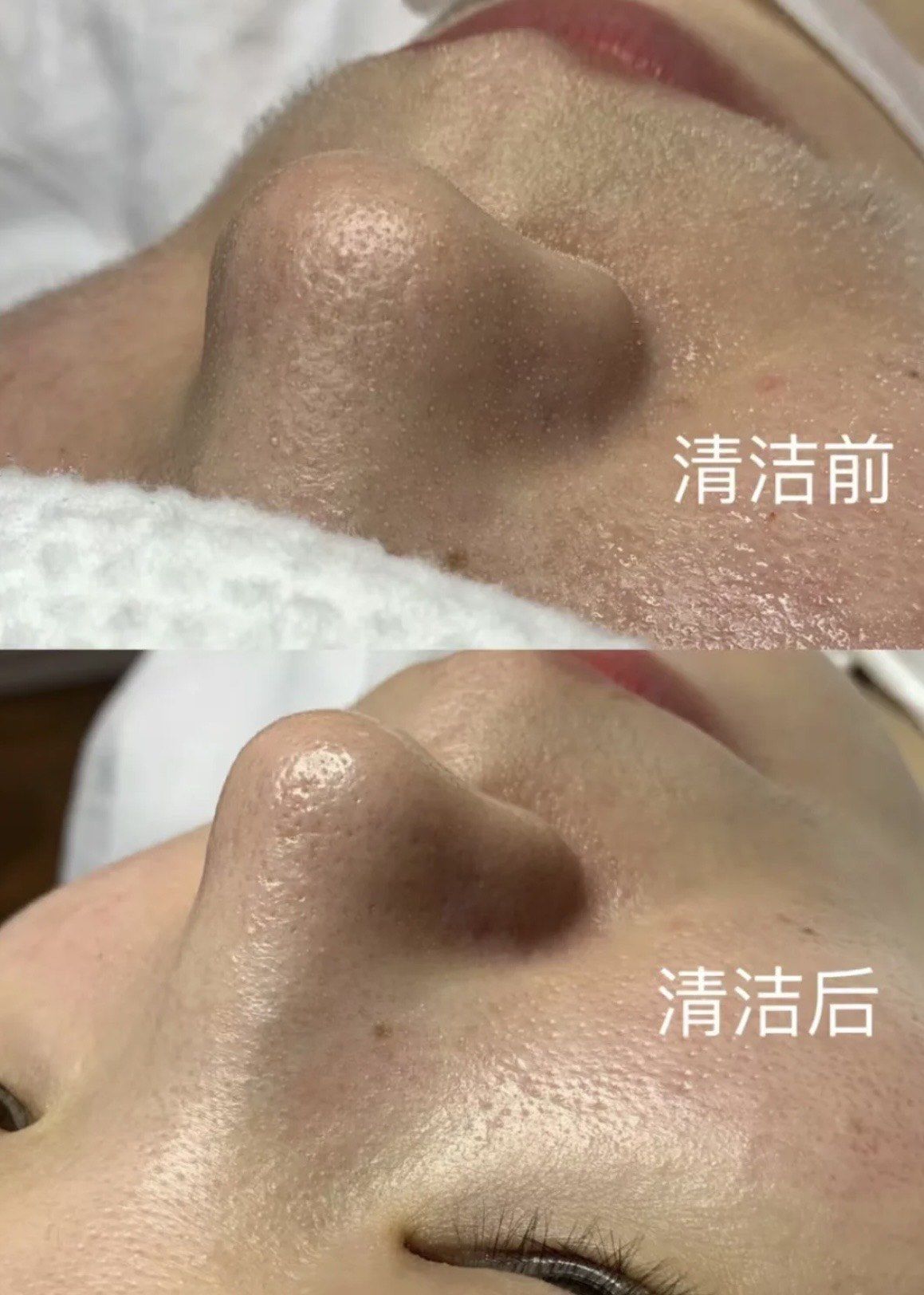 想要晶莹剔透的皮肤
不止补水美白还有深层清洁
#清洁 #毛孔清洁