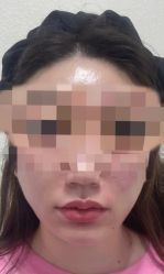 体验后-澳尔颜选医疗美容