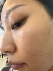 -长沙雅美医疗美容医院