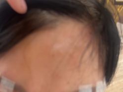 体验后-四川米兰柏羽医学美容医院