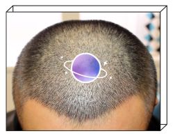 -大麦微针植发全国连锁