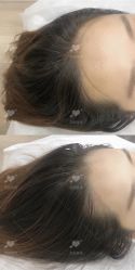 -西施无菌半永久纹绣眉眼影唇轻增发纹发际线