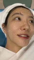 体验后-坤如玛丽·医疗美容中心