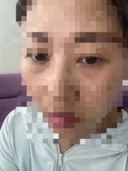 点击看大图 -广州美莱医疗美容医院