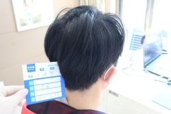 -大麦微针植发丨全国连锁