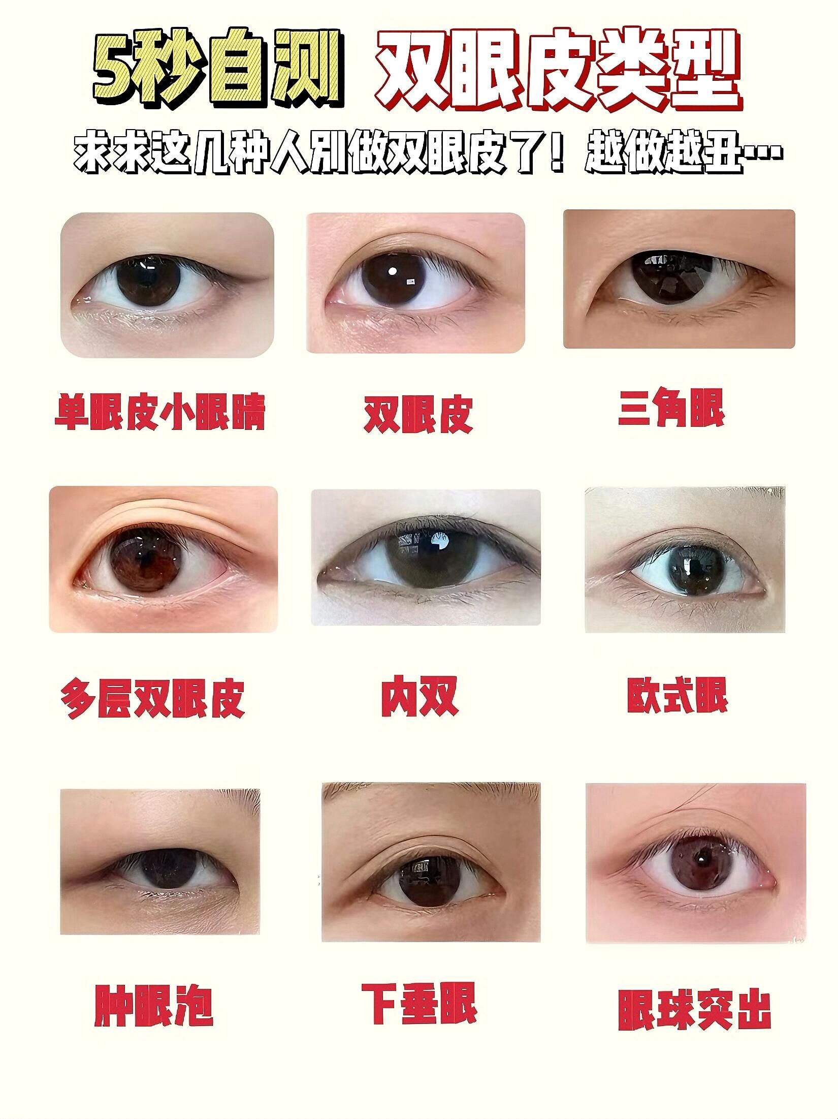 双眼皮大揭秘
