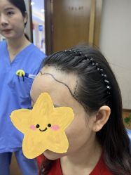 点击看大图 -大麦微针植发全国连锁