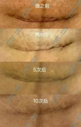 -贝爱时刻月子中心(宝安妇幼店)