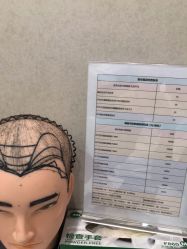 -熙朵美学植发连锁