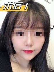 -素美医疗美容·西南眼鼻整形·修复基地