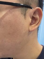 体验后-重庆联合丽格第五医疗美容医院