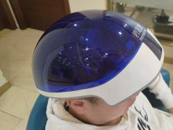 -碧莲盛·不剃发植发