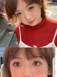 -Yestar 嘉兴艺星医疗美容医院