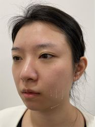 -Yestar重庆艺星医疗美容医院