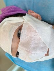 -北京米扬丽格医疗美容·联合丽格鼻整形中心