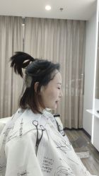 -大麦微针植发全国连锁