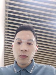 体验后-素美医疗美容·西南眼鼻整形·修复基地