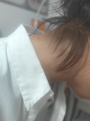 -北京美痣堂古方祛痣斑疣瘊