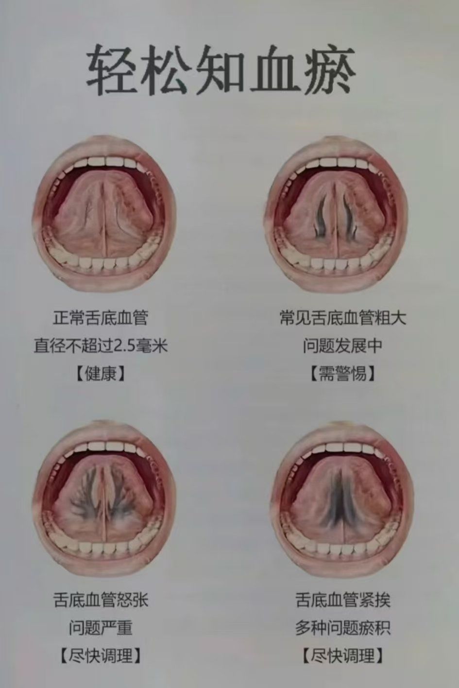 所以中医学还是非常神奇的呢
以前经常去医院,都要让我们来看舌头