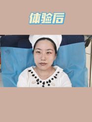 体验后-哈尔滨瑞丽医疗美容医院
