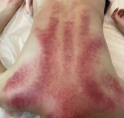 点击看大图 -阅年轻·AI家庭健康体质调理