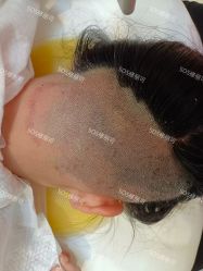 -SOS修丽可.痘肌修复中心