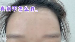 体验后-JS医疗美容