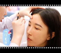 体验后-大麦微针植发全国连锁