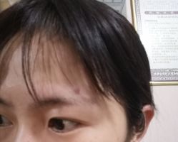 -北京美痣堂古方祛痣斑疣瘊