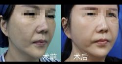 -上海华美医疗美容医院