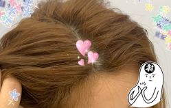 -大麦微针植发全国连锁