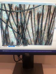 -大麦微针植发丨全国连锁