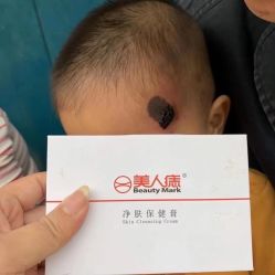 -美人痣全国连锁