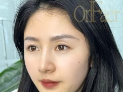 点击看大图 -OnFaer.纹眉半永久无创洗眉